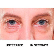 Load image into Gallery viewer, Avon Anew Platinum Instant Eye Smoother - 15ml